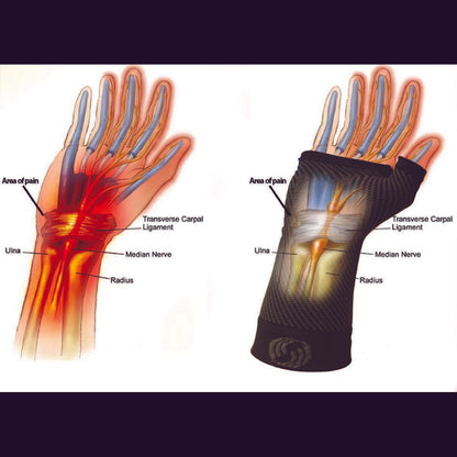 Sports Wrist Compression Sleeve (WS6) - Black